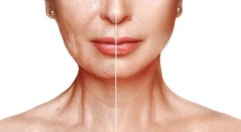 An image of a woman's face and neck represents her skin in her youth and her skin that has aged