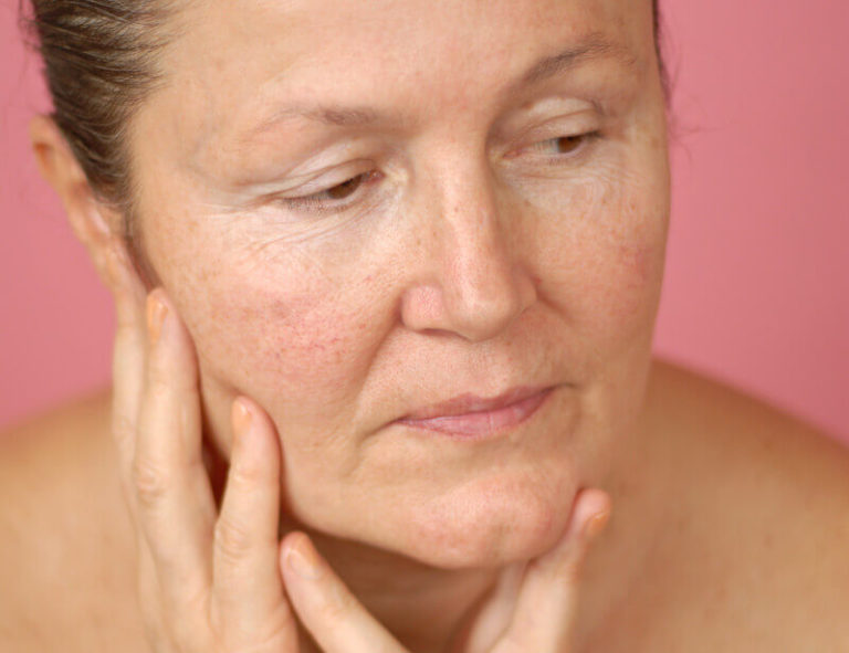 what-causes-a-double-chin-skinworks-dermatology-dermatology