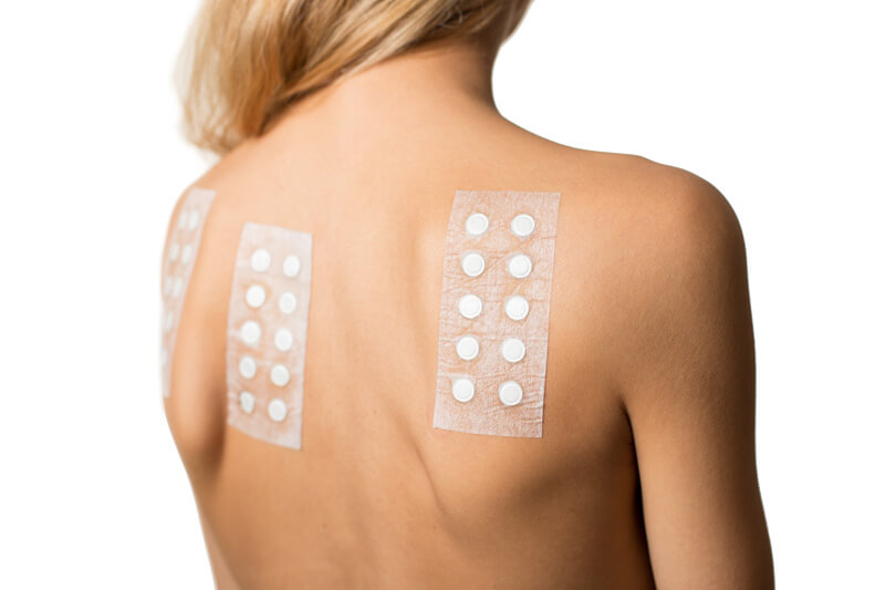 Skin Patch Test on Woman's Back