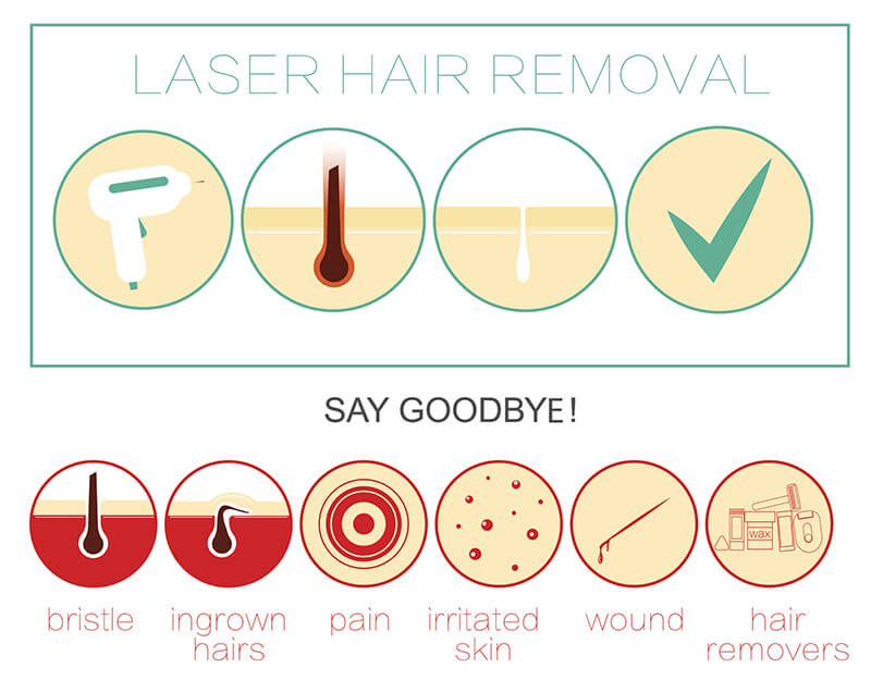 Using Laser Hair Removal to Eliminate Ingrown Hair - Vibrance