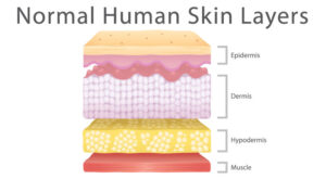 A graphic showing normal human skin layers