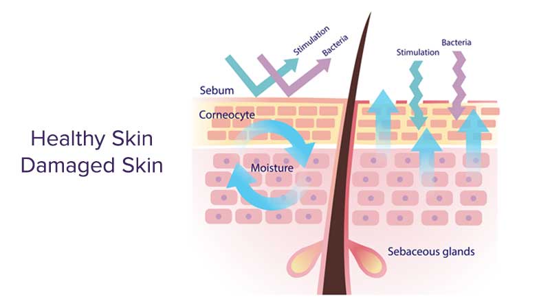 An infographic showing healthy skin vs. damaged skin