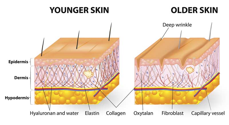 A comparison of the layers of skin between younger and older skin