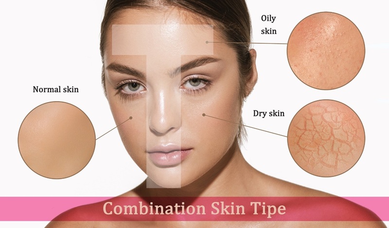 An image of a woman’s face with close up images depicting the different skin types combination skin, normal skin, oily skin, and dry skin